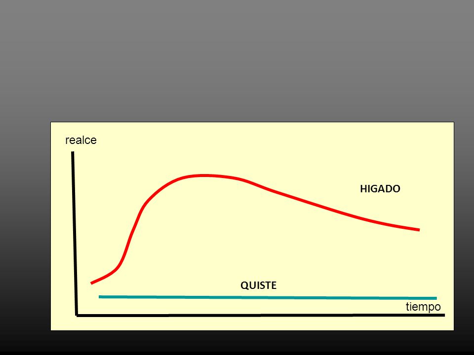 Quiste hepatico simple complicado